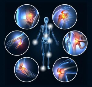 Acute Pain Causes, Symptoms, and Treatments