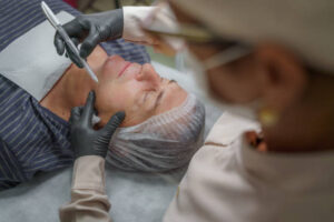 The Cost of Face Reconstruction Surgery: What You Really want to Be aware