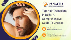 Top Hair Transplant In Delhi